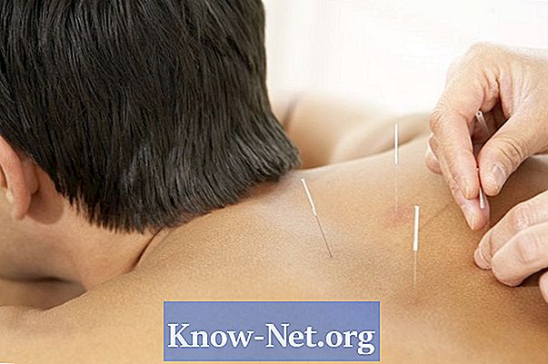 Akupunktúra és perifériás neuropátiás fájdalom - Cikkek