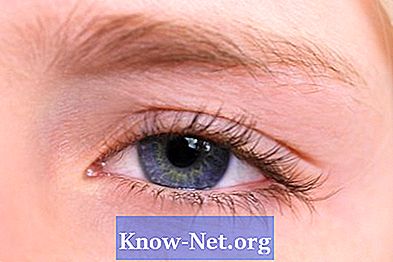 Kako olajšati krvave oči zaradi alergije
