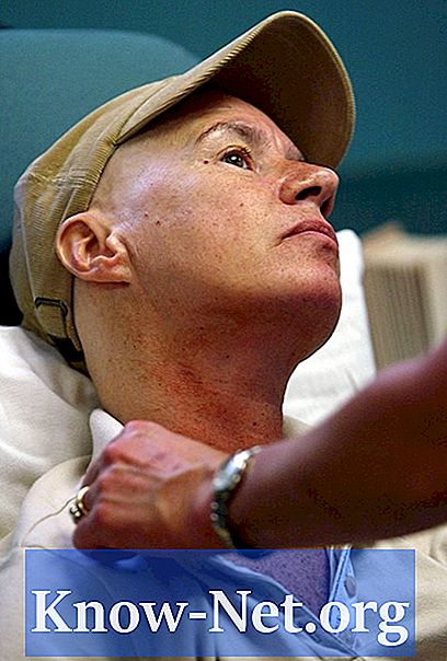 Sådan lindre hudproblemer hos en kemoterapi patient