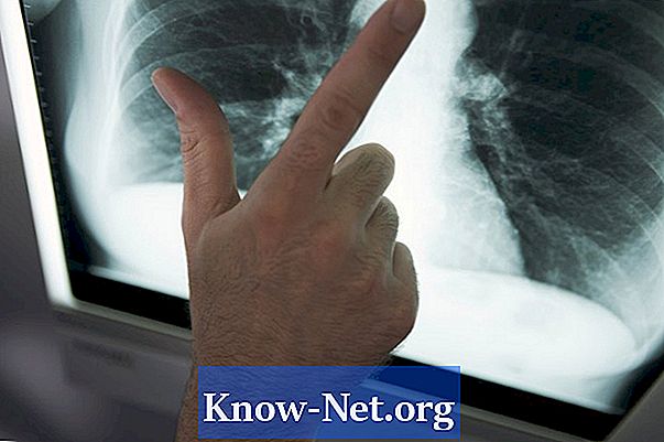 Comment arrêter la chimiothérapie en cas de cancer du poumon avancé