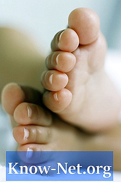 Как лечить вросший ноготь ребенка
