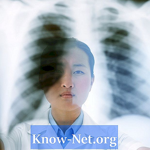 Difuzna parenhimska pljučna bolezen - Članki