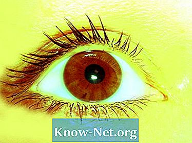 Cosa significano le macchie oculari?