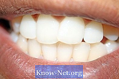 Cum să îngrijești tăieturile din gură în apropierea dinților