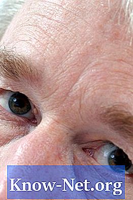 Was sind die Behandlungen für Augenringe aufgrund der Fetttransplantation?