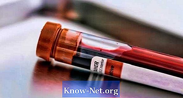 Quel type de test sanguin mesure la quantité de cortisol? - Des Articles