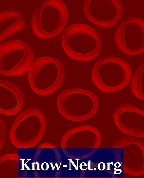 Domáce prostriedky pre krvné zrazeniny - Články