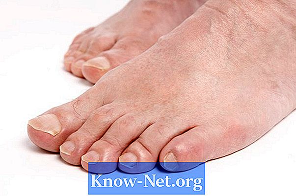 Remedii interne pentru piciorul sportiv și ciuperca de unghii
