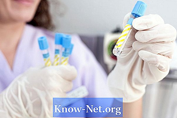 Нормални ензимски резултати тестова крви