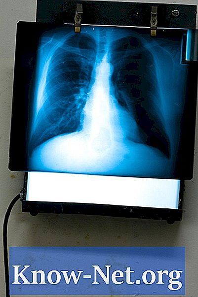 Salário de técnico de raio-x VS salário de radiologista