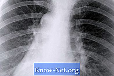 Symptomer på Klebsiella lungebetennelse