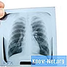 Hvordan er røntgen fra en ryger?