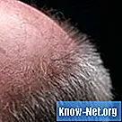 Hvordan forhindre hårtap forårsaket av prednison