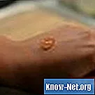 Jak usunąć wosk ze skóry