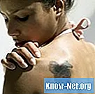 Hvordan fjerne en tatovering med syre peeling