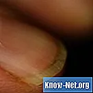 Cómo quitar las manchas debajo de las uñas.