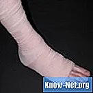 Cara merawat tendonitis kaki dan pergelangan kaki