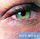 Kako liječiti crno oko (modricu)