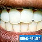 Какво означават тъмните петна по венците?