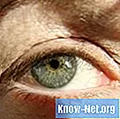 Symptômes des yeux sensibles - Santé