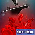 De drie mogelijke soorten hemolyse in bloedagarplaten