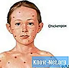 Etapas tempranas de la varicela