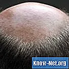 ¿Qué problemas del cuero cabelludo son comunes en los ancianos?