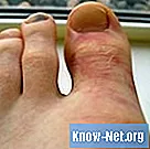 Apakah penyebab kesakitan di hujung jari dan kaki?