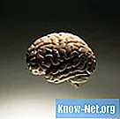 Was sind die Symptome von Blutgerinnseln im Gehirn?