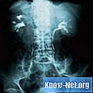 ¿Cuáles son los tratamientos para la espina bífida oculta en adultos?