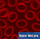 Домаћи лекови за стварање крвних угрушака