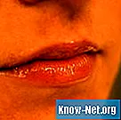 Príznaky sucha a trpkosti v ústach