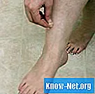 Symtom på sural nervskada - Hälsa