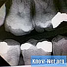 Симптоми на повтарящ се синузит: Зъбобол и челюст