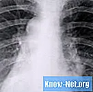 Lungsvamp symptom
