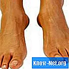 Uso del cloro per trattare i funghi sui piedi